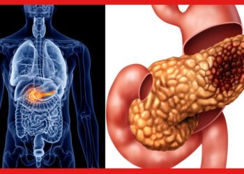 Pancreatic cancer: অগ্ন্যাশয়ের ক্যান্সার চিহ্নিত করা যায় না সহজে, উপসর্গগুলি জেনে নিয়ে থাকুন সতর্ক