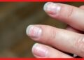 White spots on nails: এড়িয়ে যাচ্ছেন নখের সাদা দাগ! শরীরে লুকিয়ে ভয়ঙ্কর রোগ