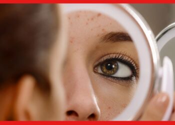 Acne Myth: অ্যাকনে মিথ কী জানেন? এটাই তো ক্ষতি করছে আপনার স্কিনের
