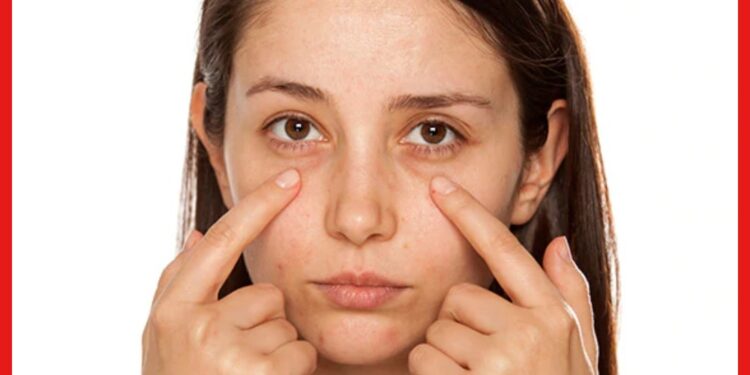 Dark circles remedy: চোখের চারপাশে ডার্ক সার্কেল? রইল দূর করার কিছু ঘরোয়া উপায়