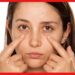 Dark circles remedy: চোখের চারপাশে ডার্ক সার্কেল? রইল দূর করার কিছু ঘরোয়া উপায়