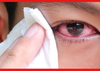 Eye care: ঠান্ডায় চোখ লাল? ভালো থাকতে এই নিয়মগুলি মেনে চলুন