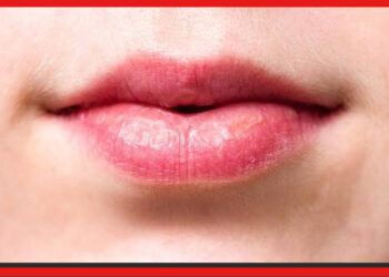 Dry lip remedies: নাভিতে তেল দিলেই ঠোঁট ফাটা কমবে, জানুন উপায়