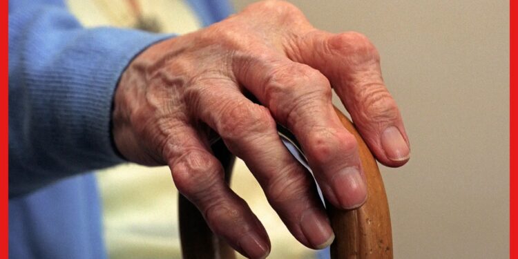 Arthritis: হাঁটু বা শরীরের জয়েন্টের ব্যথায় নাজেহাল! আপনাকেও কাবু করছে না তো আর্থ্রাইটিস ?