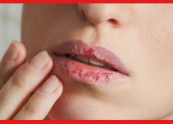 Lips care tips: শীতে ঠোঁট ফেটে চামড়া উঠছে? ঘরেই আছে সমাধান