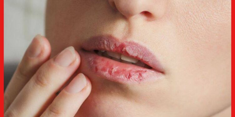 Lips care tips: শীতে ঠোঁট ফেটে চামড়া উঠছে? ঘরেই আছে সমাধান