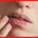 Lips care tips: শীতে ঠোঁট ফেটে চামড়া উঠছে? ঘরেই আছে সমাধান