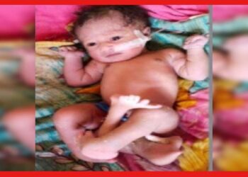 Four Legs Baby in Bangladesh: বাংলাদেশে জন্ম নিল ৪ পায়ের শিশু! এমনটা কেন হয়?