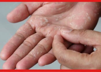 Dry Hand Care Tips: শুষ্ক হাত থেকে উঠছে চামড়া ? জেনে নিন ত্বক ভালো রাখার ঘরোয়া প্রতিকার