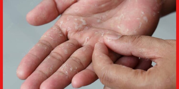 Dry Hand Care Tips: শুষ্ক হাত থেকে উঠছে চামড়া ? জেনে নিন ত্বক ভালো রাখার ঘরোয়া প্রতিকার