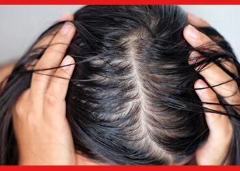 Oily Scalp Problem: শ্যাম্পু করার পরেও কাটছে না চুলের তেলতেলে ভাব! সমস্যাটা কোথায় জানেন ?