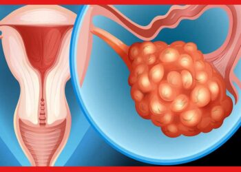 Ovarian Cyst Problem: বেশিরভাগ মেয়েদের ওভারিতে সিস্ট, সন্তান ধারণে অসুবিধা! লক্ষণ দেখে এখনই সাবধান হন