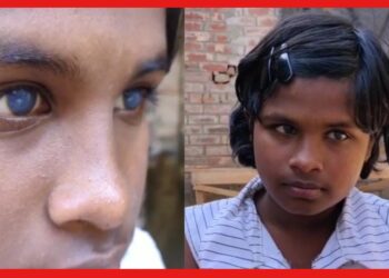 Puja Roy: নষ্ট হয়ে যাচ্ছে চোখের মণি, সূর্যের আলোই ভরসা! ছোট পূজা চায় শিক্ষিকা হতে