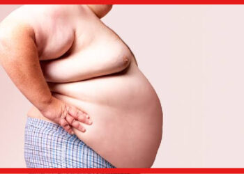 World Obesity Day 2023: অতিরিক্ত ওজন কিডনি হার্টের শত্রু, প্রাণে বাঁচতে এই ভুলগুলি করলে মুশকিল
