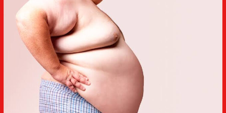World Obesity Day 2023: অতিরিক্ত ওজন কিডনি হার্টের শত্রু, প্রাণে বাঁচতে এই ভুলগুলি করলে মুশকিল