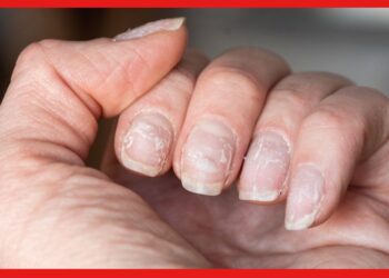 Broken Nails: বর্ষাএলেই শখের নখ ভেঙে যায় ? কীভাবে সঠিক যত্ন নিলে ভাঙবে না দেখে নিন