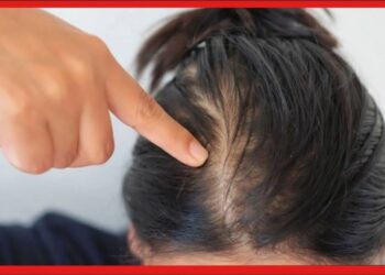 Hair Care Tips: রাতে চুল বেঁধে ঘুমাচ্ছেন! সাবধান, টাক পড়ে যাবে, করছেন মস্ত বড় ভুল