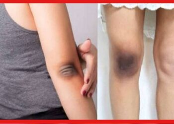 Dark Elbows: কনুই-হাঁটুতে কালো ছোপ? পুজোর আগে জেনে নিন দূর করার উপায়