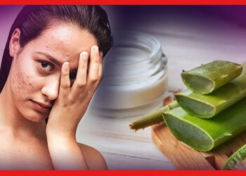 ফাঙ্গাল অ্যাকনের সমস্যায় ভুগছেন? জানুন ন্যাচারাল উপায়ে কীভাবে দুর করা যায়