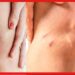 Scars Remove: হাঁটুর কাটা দাগ নিয়ে ছোট ড্রেস পরতে লজ্জা? পুজোর আগে এই টোটকাতেই হবে দারুন কাজ