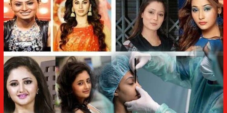 নাক কেটে সোজা, ঠোঁট কেটে সোজা, সিরিয়ালের এই অভিনেত্রীদের চেহারা দেখলে চমকে যাবেন