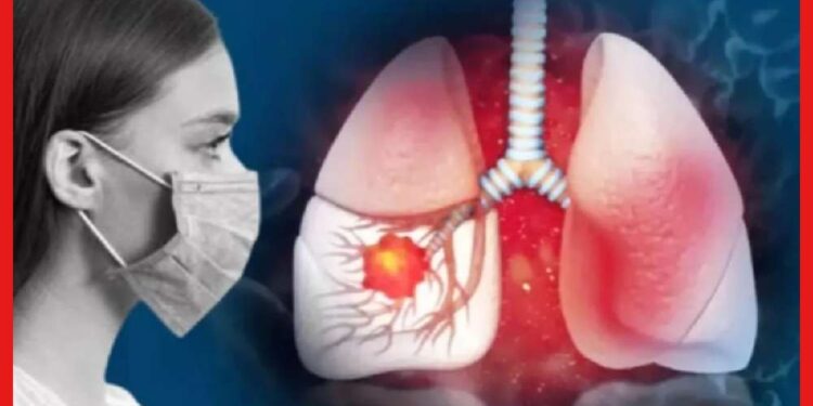 Chinese Pneumonia: করোনার পর নয়া আতঙ্ক চিনা নিউমোনিয়া, লক্ষণ চিনে নিয়ে থাকুন সতর্ক