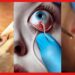 Worms in women’s Eyes: মহিলার চোখে কিলবিল করছে পোকা, দেখে তাজ্জব চিকিৎসকরা! এমন ভুল করবেন না