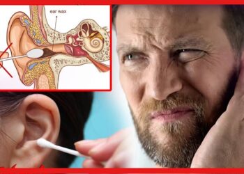 Earwax Removal Tricks: ইয়ারবাডস দিয়ে কান পরিষ্কার করে কত বিপদ ডাকছেন জানেন? ঘরোয়া পদ্ধতি অবলম্বন করুন
