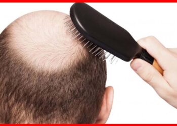 Baldness: মাথায় টাক নিয়ে চিন্তিত? চুল গজানোর জিনিস আপনার হাতের কাছেই আছে