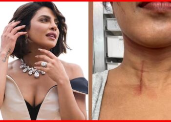 Priyanka Chopra: শ্যুটিং সেটে গুরুতর আহত প্রিয়াঙ্কা চোপড়া ! কী হল বলি সুন্দরীর ?
