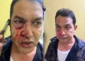 Mukundapur TMC BJP Clash leaves former MLA Humayun Kabir injured outside East Jadavpur Police Station