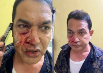Mukundapur TMC BJP Clash leaves former MLA Humayun Kabir injured outside East Jadavpur Police Station