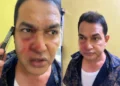 Mukundapur TMC BJP Clash leaves former MLA Humayun Kabir injured outside East Jadavpur Police Station