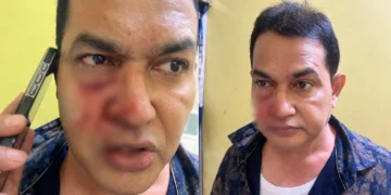 Mukundapur TMC BJP Clash leaves former MLA Humayun Kabir injured outside East Jadavpur Police Station